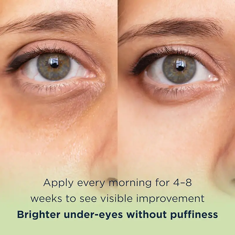 MATKAS Puffy Eye Cream